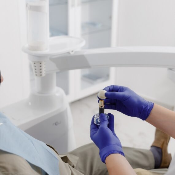 how to care for dental implants in new york for long-lasting results